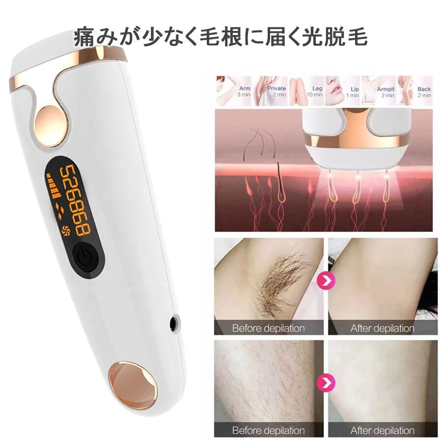 最新機種 IPL脱毛器 NEWクオーツランプ採用 フラッシュ 男ウケ 女ウケ