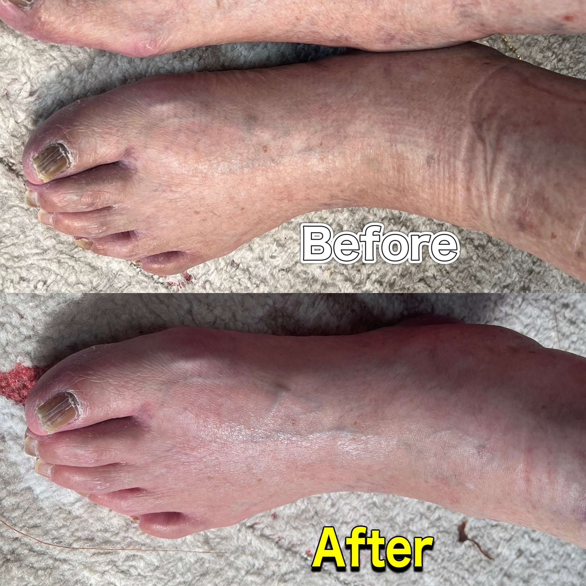 ファシアアミノジストローション チノザメソッド×ファシア | エステ