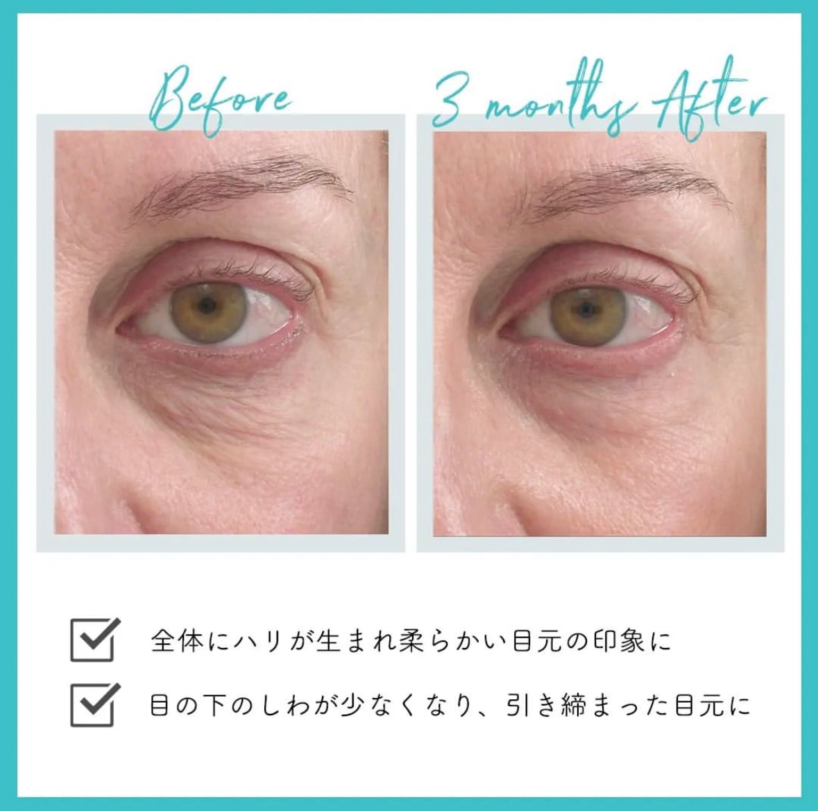 ルミネート アイジェル ジャンマリーニ | dr.label