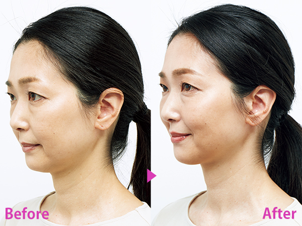 頭皮ケア美顔器】を40代50代がお試し！ビフォーアフター | 美ST ONLINE