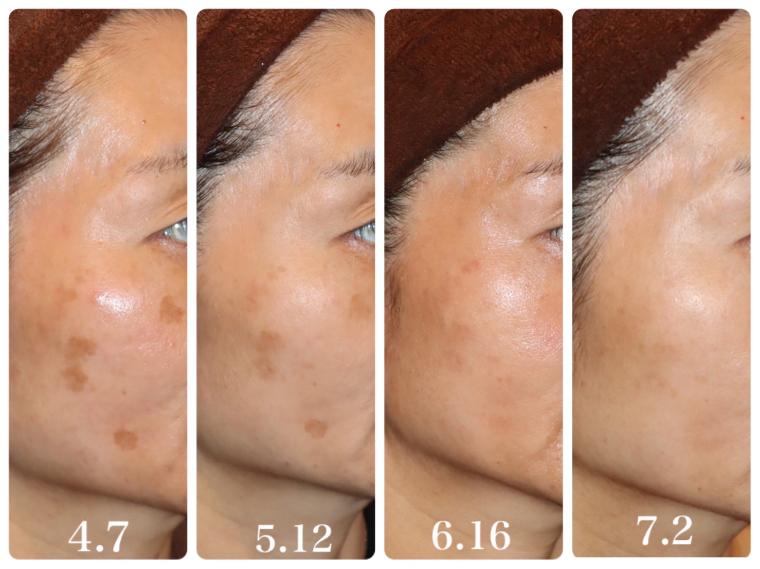 シミ、シワ、たるみ、ニキビ、あらゆる肌トラブルを改善に導くドクター