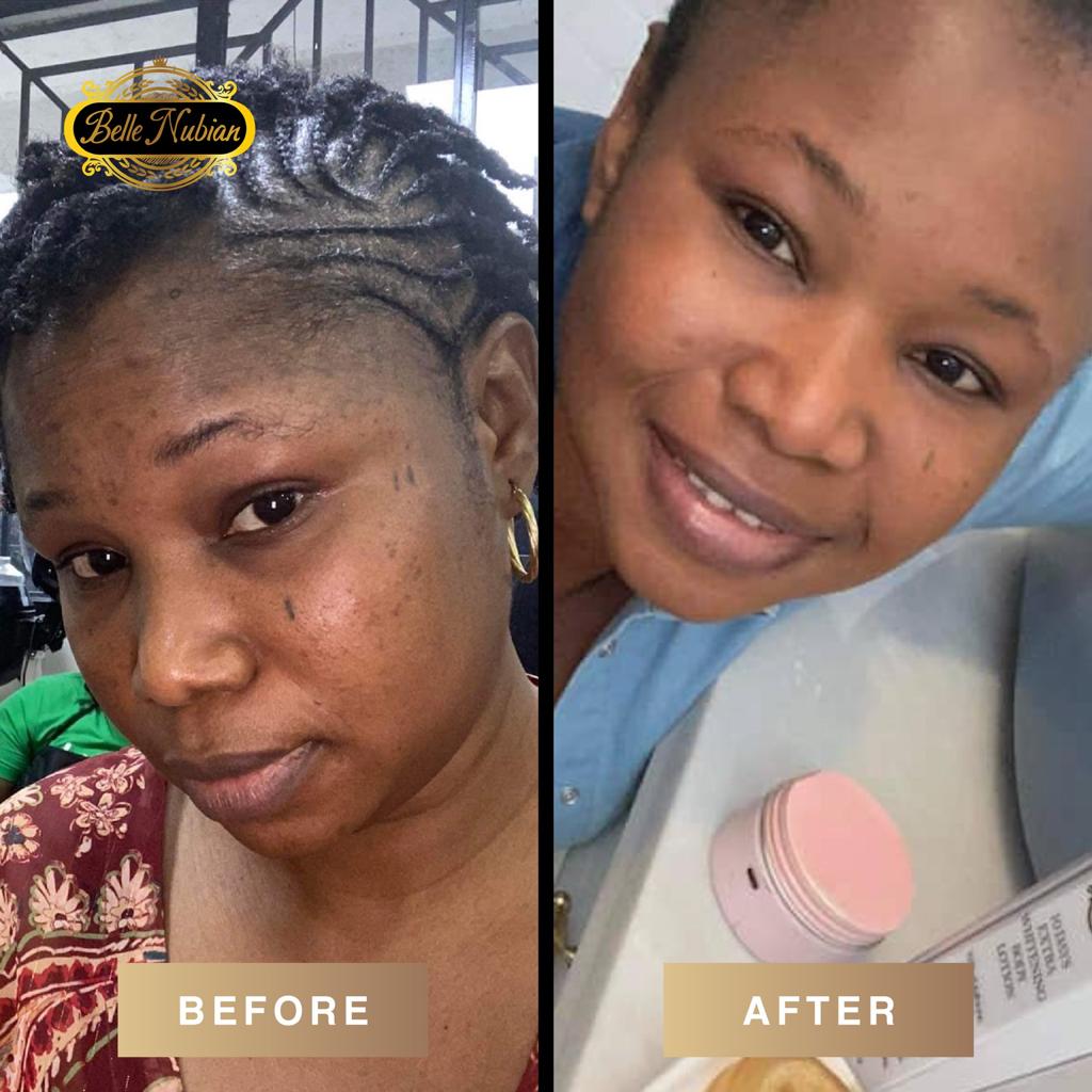 Pink Clay Mask | Skin Care Products – Belle Nubian Skincare