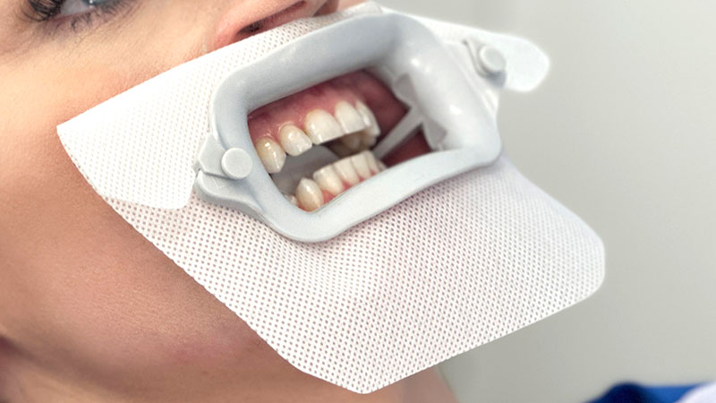 How to use - beyond Whitening | 株式会社JBAbeyond Whitening | 株式