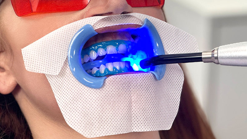 How to use - beyond Whitening | 株式会社JBAbeyond Whitening | 株式