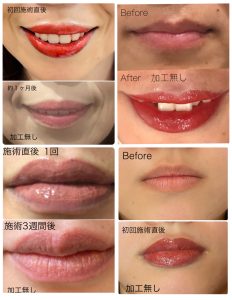 アートメイクリップUSA Softap国際ライセンス2DAYコース | アート