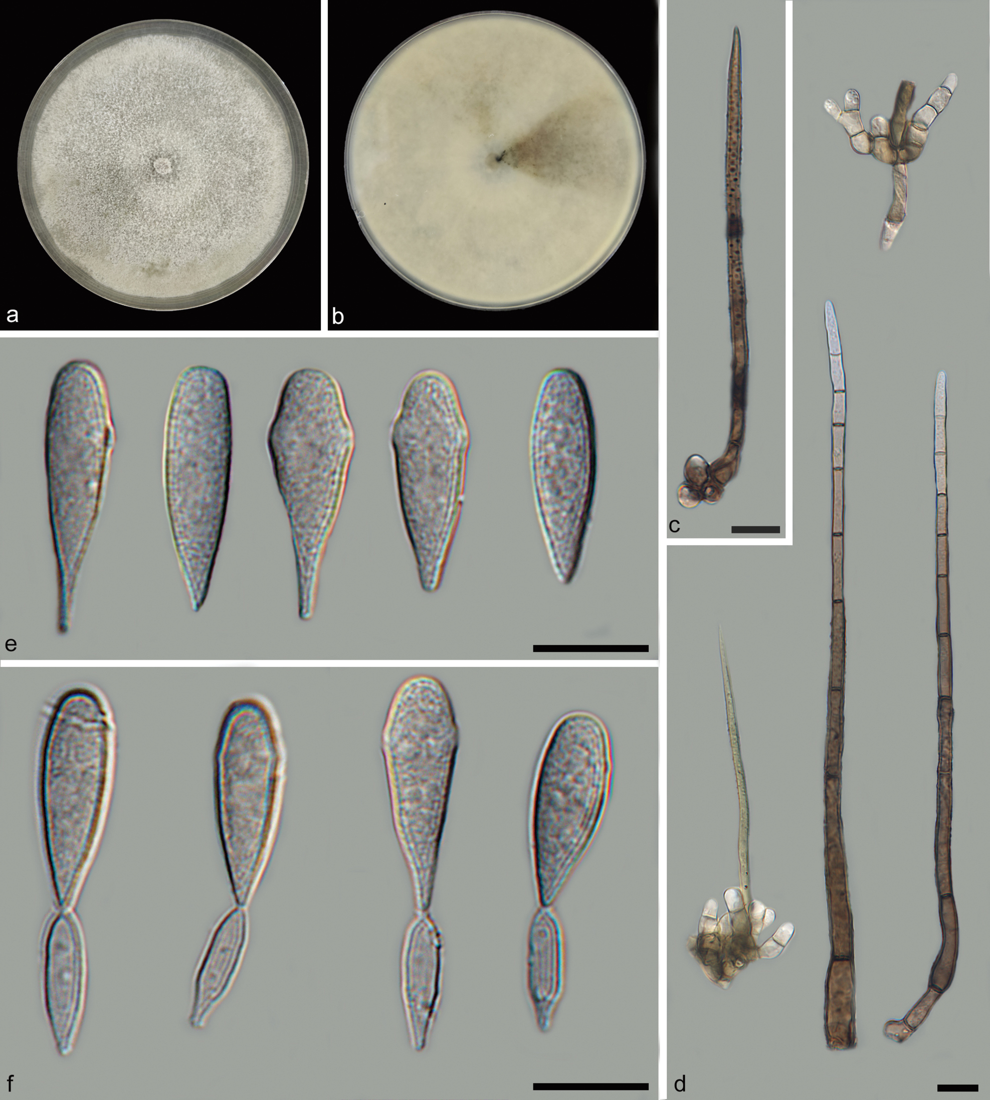 Four new species of Beltraniella (Amphisphaeriales, Beltraniaceae