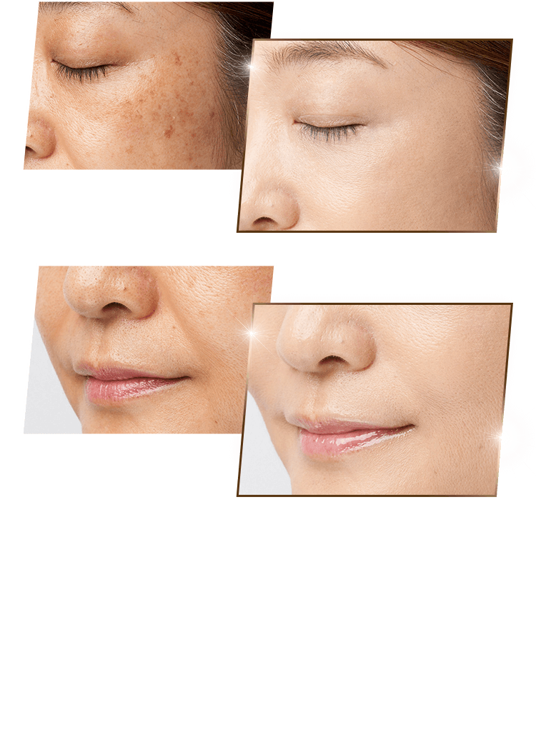 ビーバウンシー | ビズキストア商品紹介 | BIZKI.STORE（ビズキ ストア）