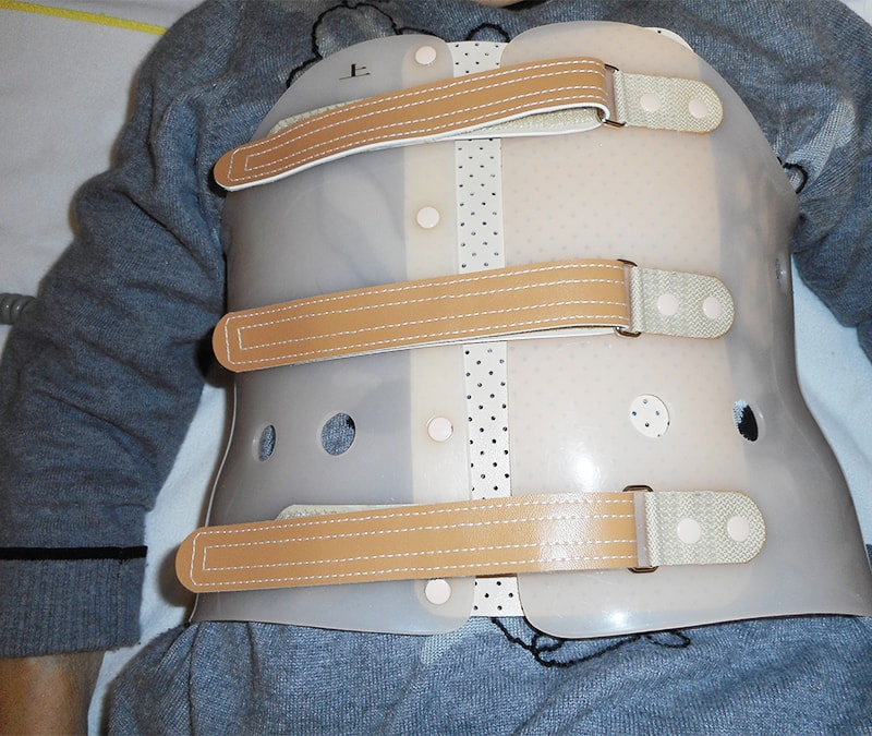 保険診療…腰椎圧迫骨折時のコルセットは見直すべき【医師が提言