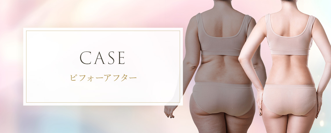 銀座店｜Pure esthe Briant（ピュアエステブリアント）