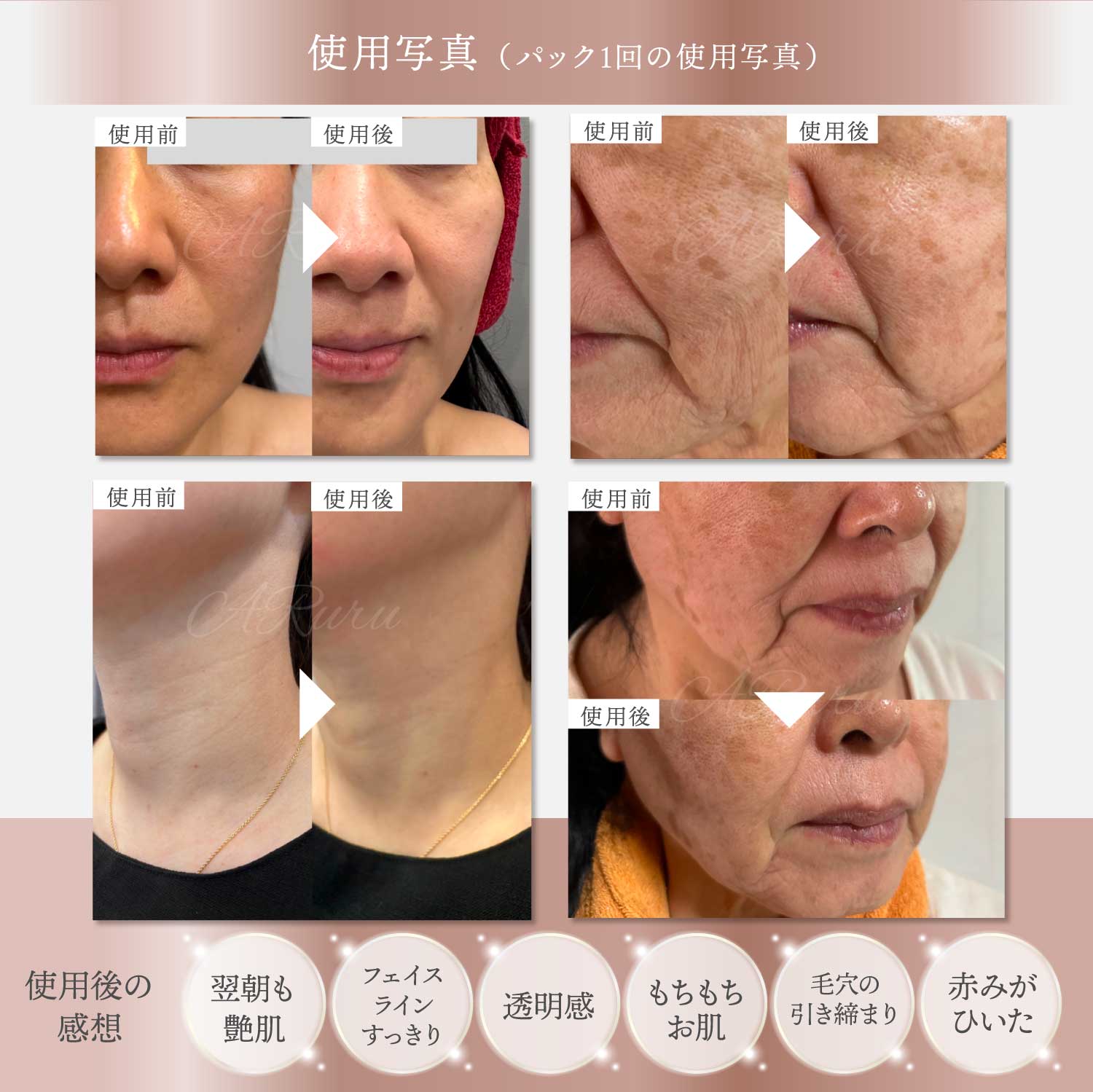 Buzzdrop / Dr.kozu ゾンビマスク フェイスパック リフトアップ 顔