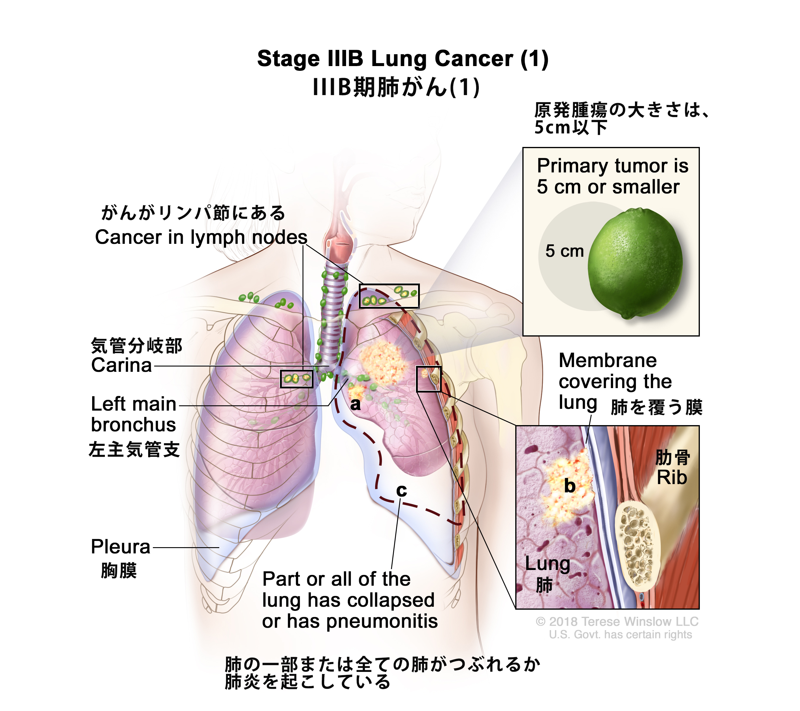 がん情報サイト | がん情報各論：[医療専門家向け]