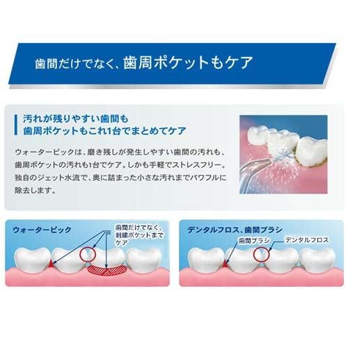 ウォーターピック WF-03J010 コードレスフリーダム 148ml クラシック