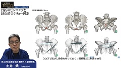 整形外科SURGICAL TECHNIQUE動画シリーズ 骨折のピンニングと経皮的