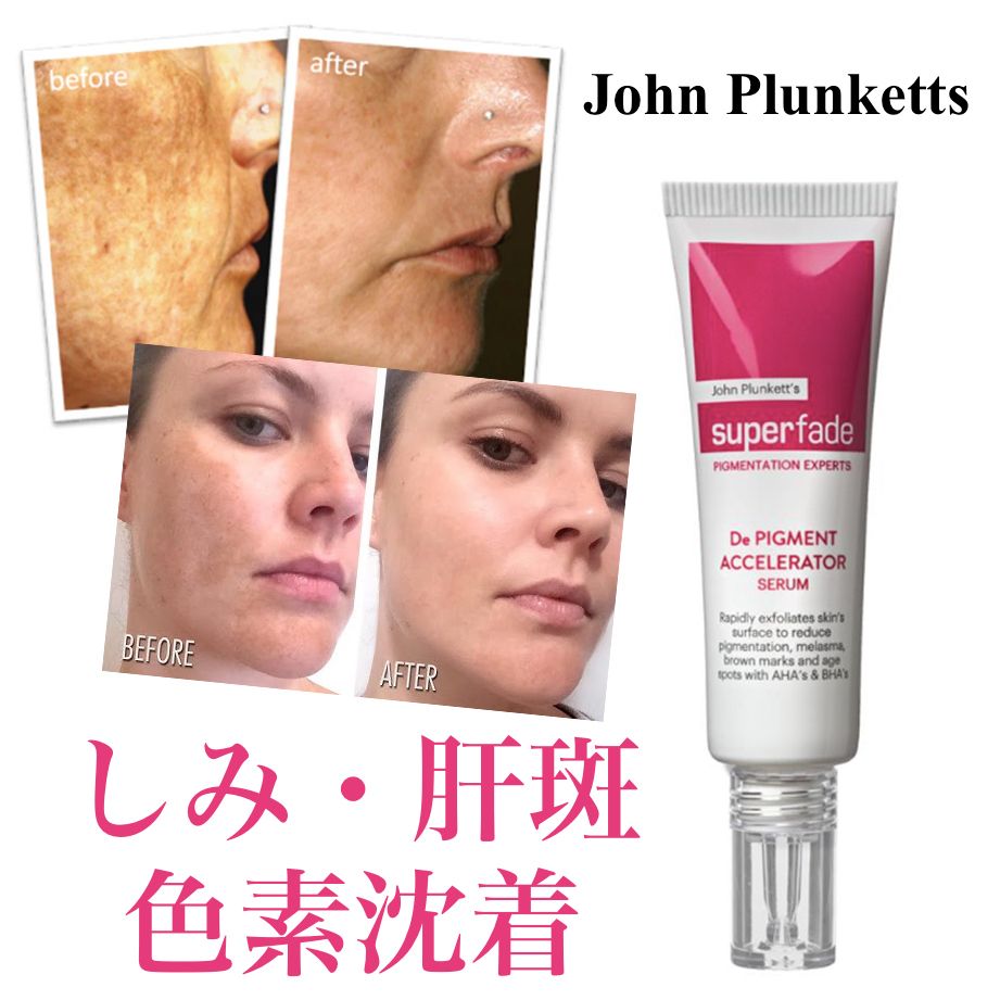 John Plunkett しみ/そばかす/色素沈着/肝斑解消 高機能セラム (美容液