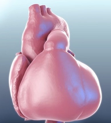 臓器の動態を3DモデリングしたUT-Heart - IMACEL Academy -人工知能