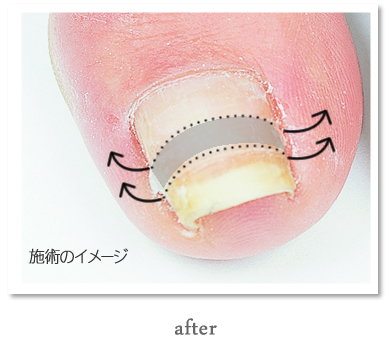 公式】宇都宮ネイルサロン&ネイルスクール ミッシュネイル [mish nai