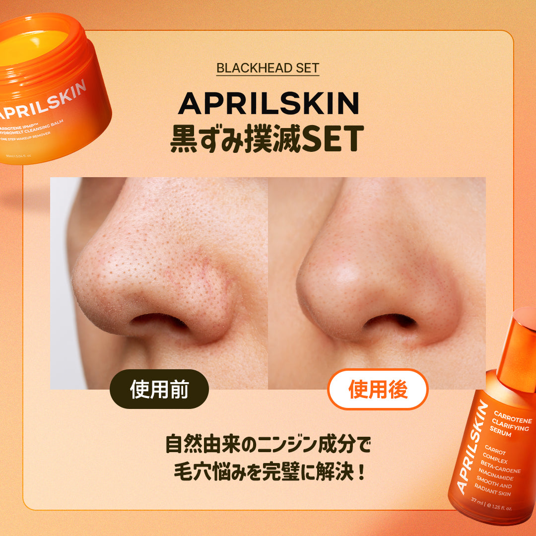 しみ、そばかす、ニキビ跡、毛穴 噂のNikki's Skin Clear 通常版