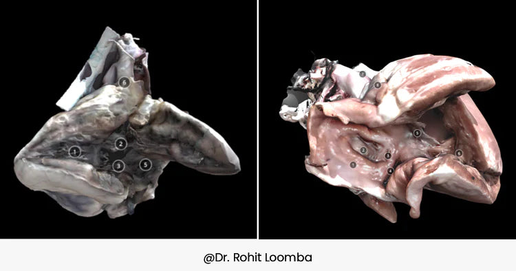 小児心臓病学における研究と学習の変革：3Dスキャン技術の活用