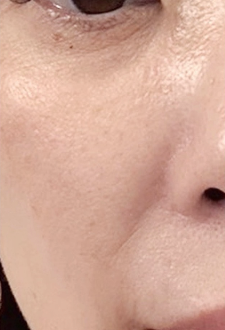 GRATiAE リフティング フェイシャルセラム 50mL