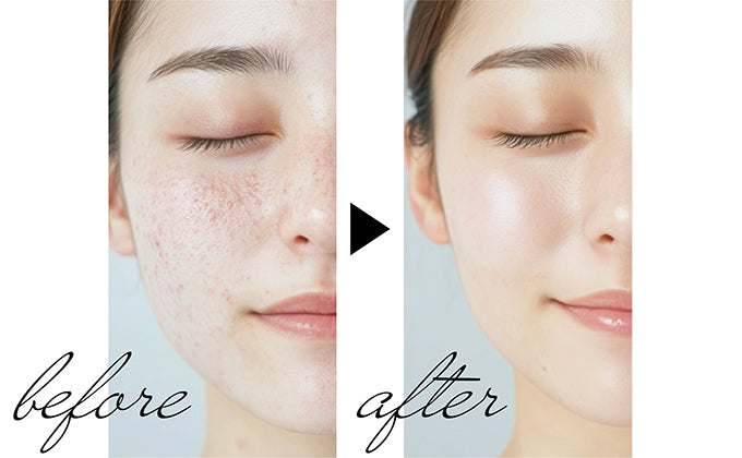 正規販売店・即日発送】レフィル（詰替え用）：V3 インテリジェント