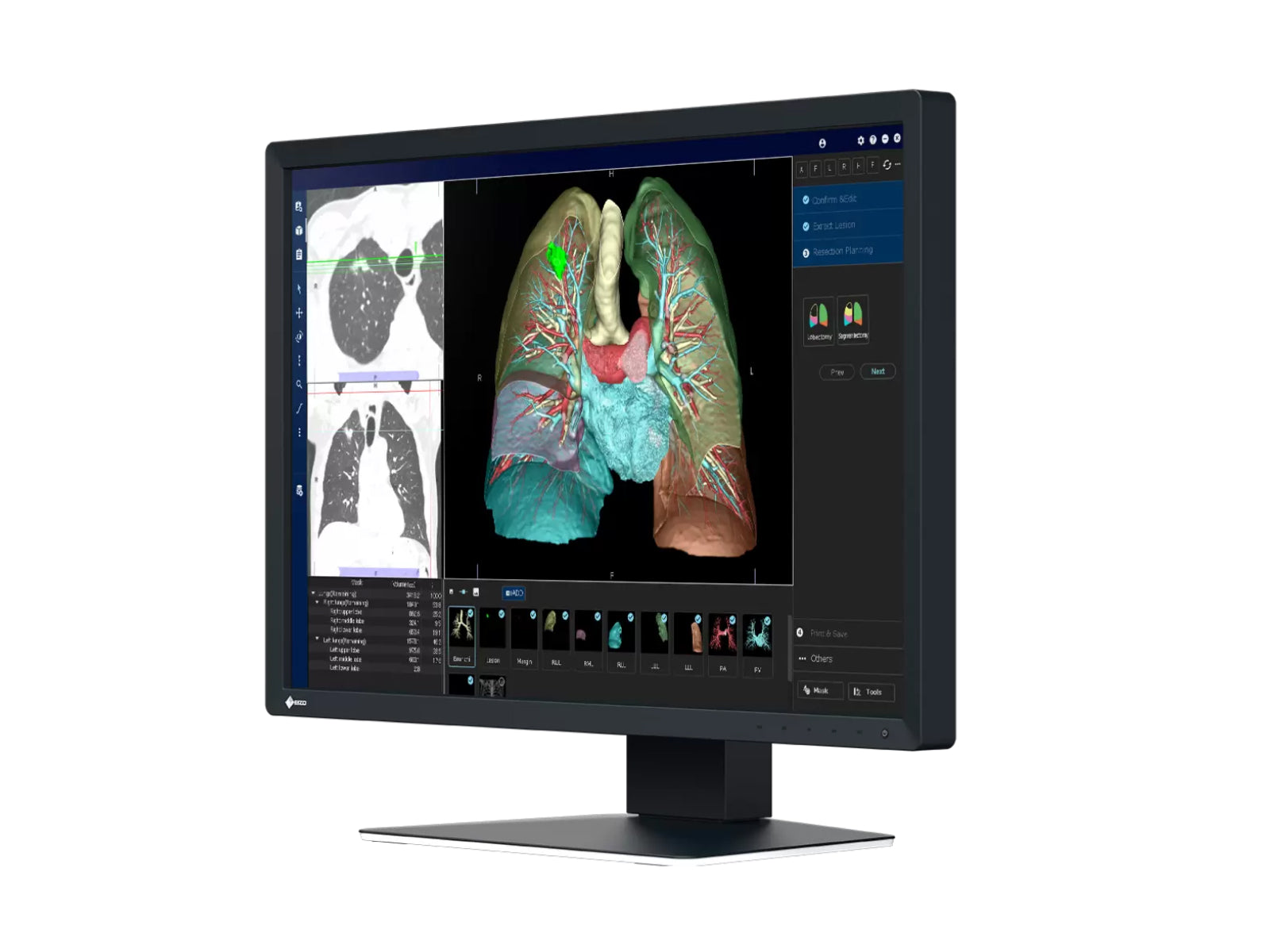 Eizo RadiForce MX243W 2.3MP 24
