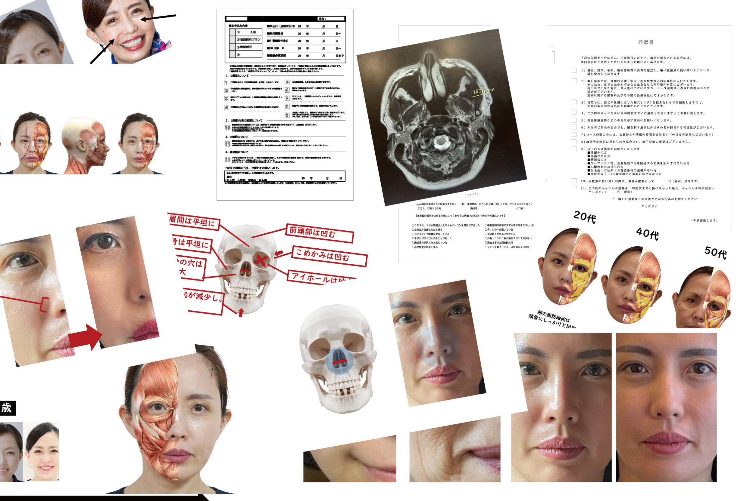 美容鍼についての説明