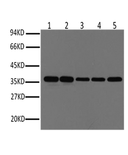 Anti-GAPDH (Mouse Monoclonal) for WB, IF & IHC | Human, Rat, Mouse