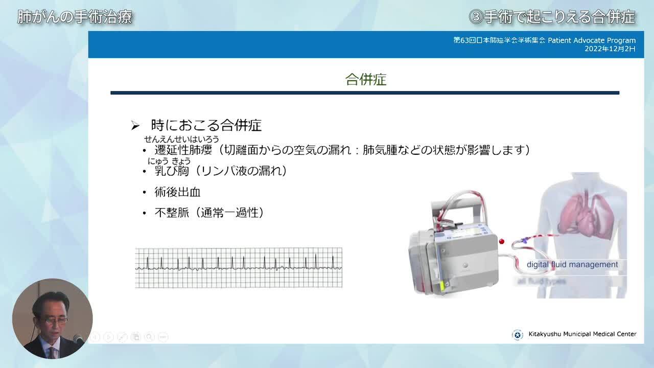 第63回日本肺癌学会学術集会 : 読売新聞オンライン