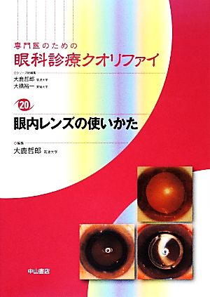 専門医のための眼科診療クオリファイ(20) 眼内レンズの使いかた 中古本