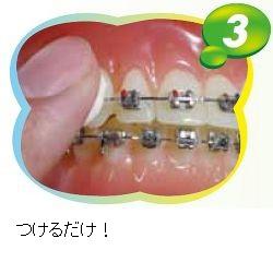 松風 GISHY GOO(ギシ グー) 5ml ホワイト 歯科矯正用粘膜保護材 5本