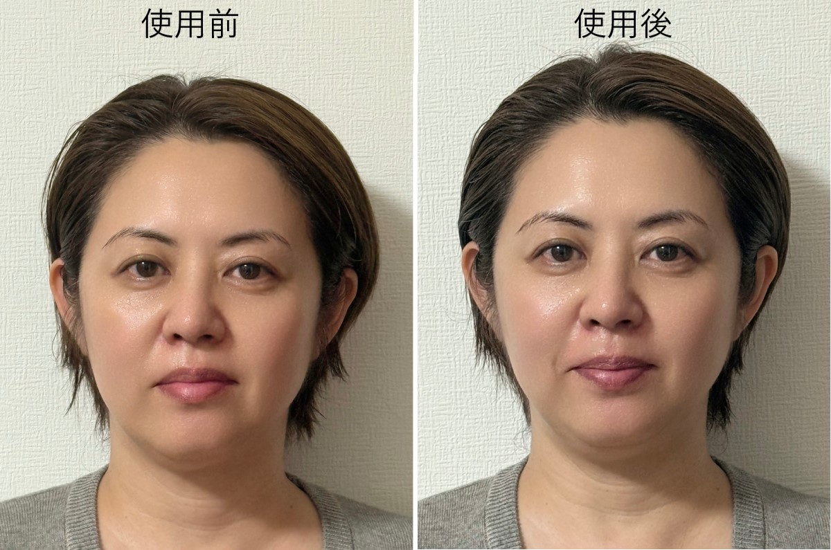 プロがパナソニック「バイタリフト かっさ」を実機検証！口コミの実態