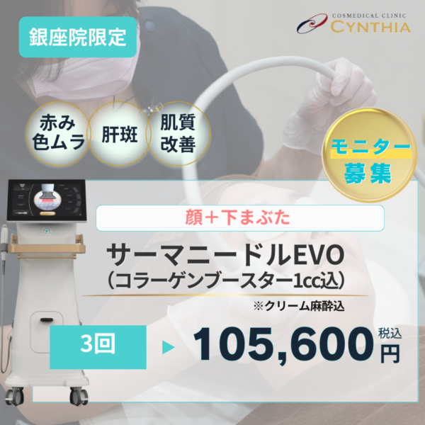 シルファームの進化版！！サーマニードルEVOによる肝斑根本治療