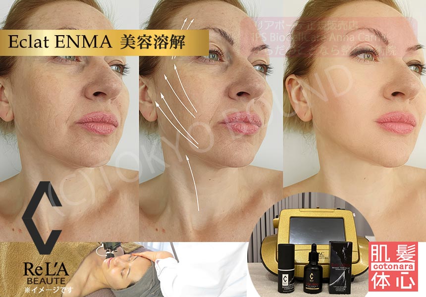 リアボーテ正規販売店】クレアスキンディゾセラム（ライト）ご購入方法