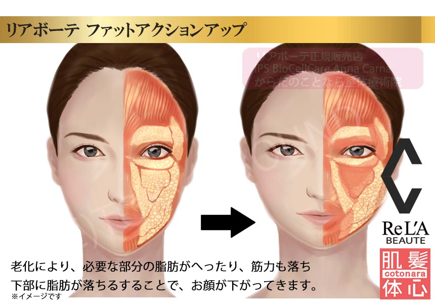 リアボーテ正規販売店】クレアスキン ファットアクションアップ（美容