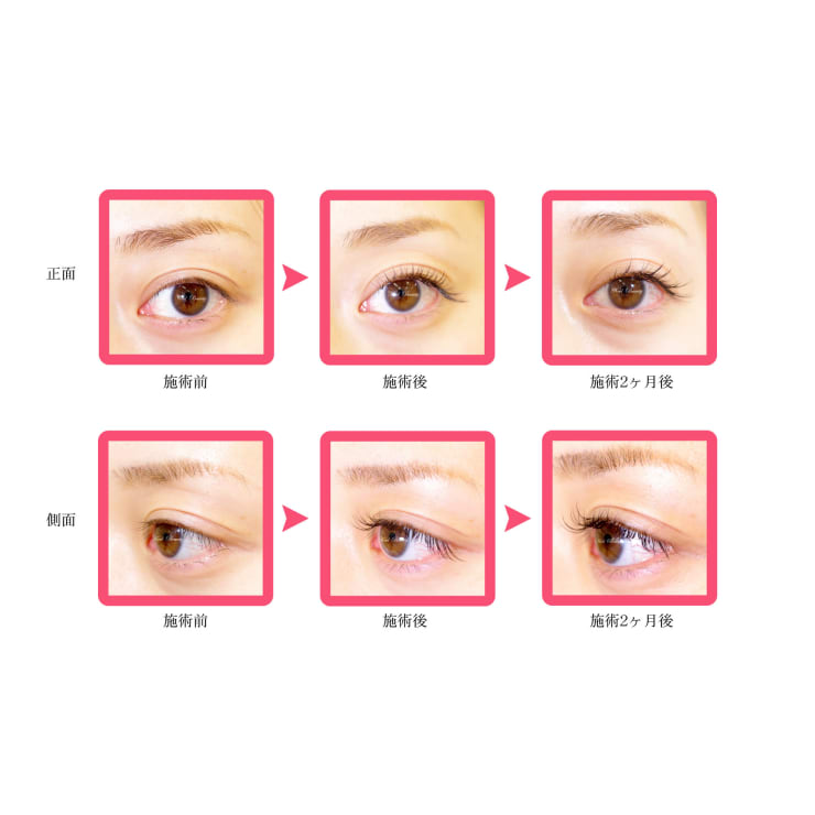 通常は高級ミンクエクステ使用しています☆シルクよりも柔らかで軽くお