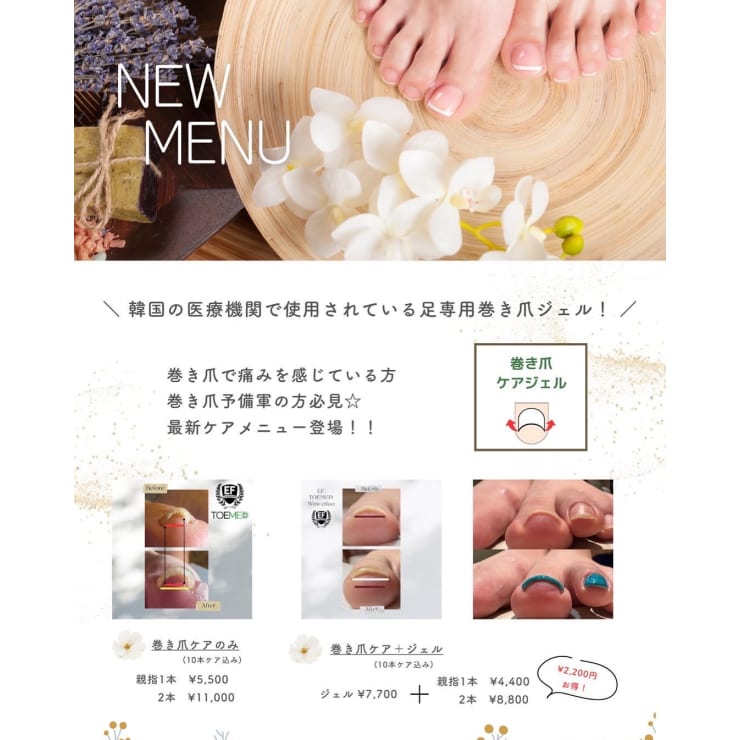 巻き爪で痛みを感じてる方、巻き爪予備軍の方必見！！巻き爪ケアジェル