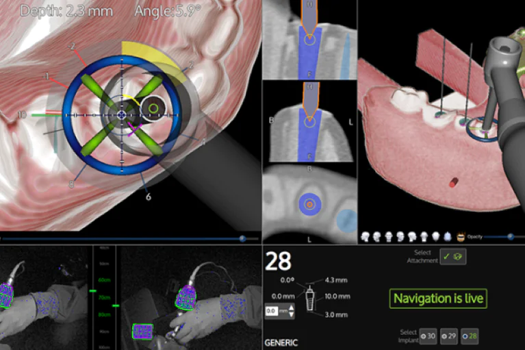 X-ガイド | クオーレ歯科クリニック