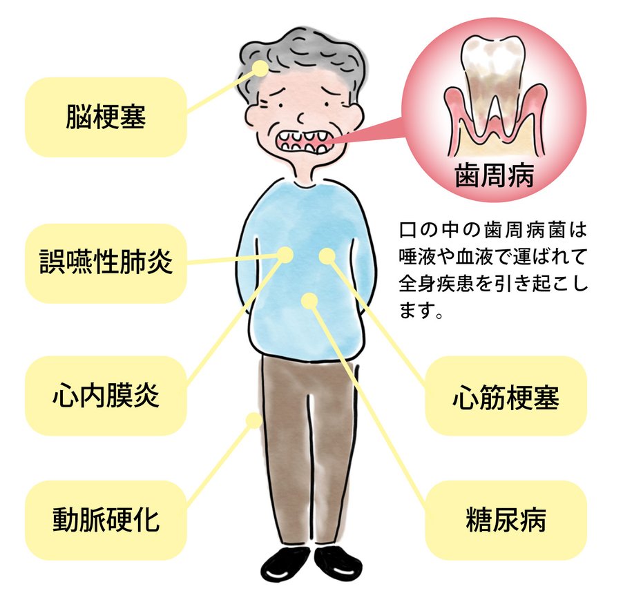 口腔ケアで高齢期の病気を予防 - LIFULL 介護(ライフル介護)