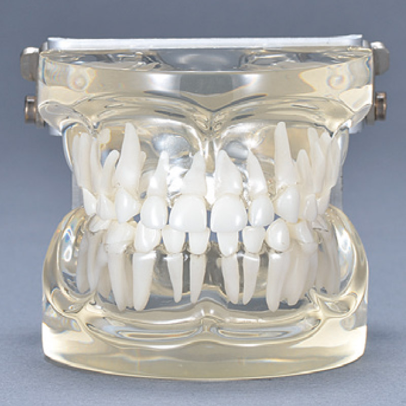 透明乳歯-永久歯交換期模型 乳歯期 3才頃の通販 | Ciモール | Ciモール