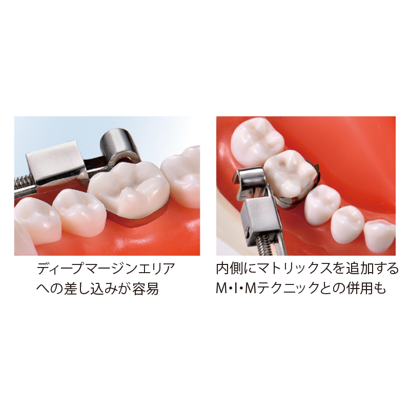 Deepマトリックス 厚さ0.035mmの通販 | Ciモール | Ciモール