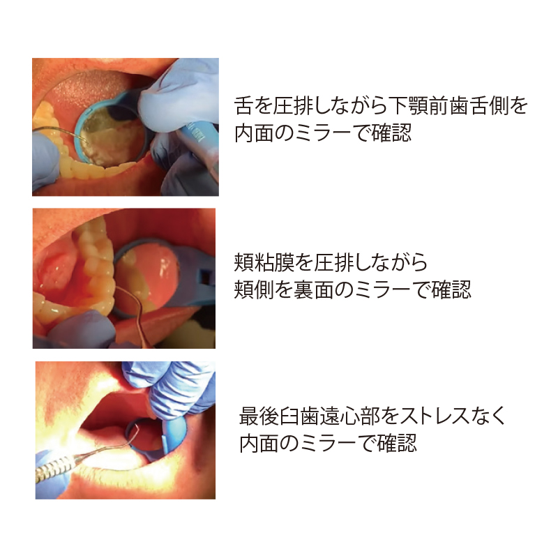 Ciモール | 歯科材料・医療用品の通販サイト | Ciモール