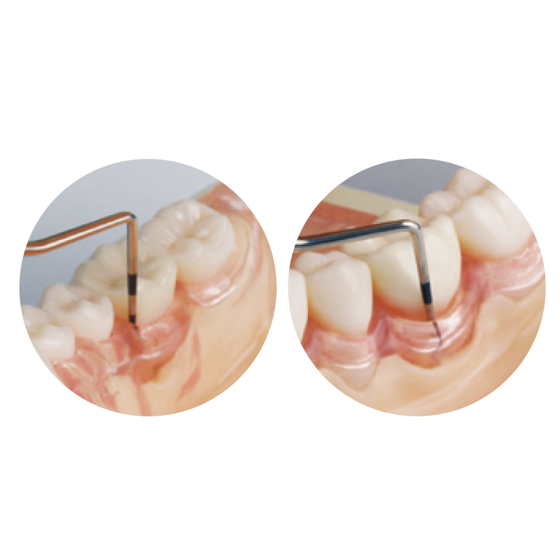 SRP用顎模型 [ニッシン]の通販 | Ciモール | Ciモール