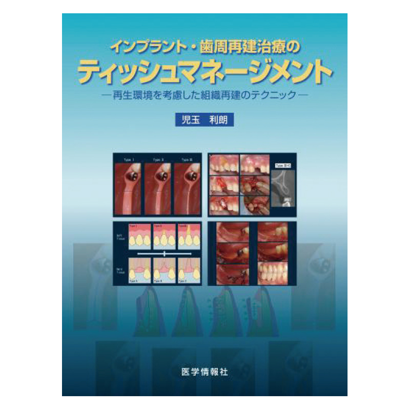 インプラント・歯周再建治療のティッシュマネージメント[医学情報社]の
