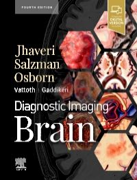 Diagnostic Imaging: Brain, 4th ed.: 洋書／南江堂