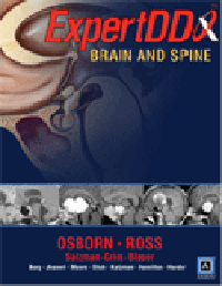 Expert Differential Diagnoses: Brain & Spine: 洋書／南江堂