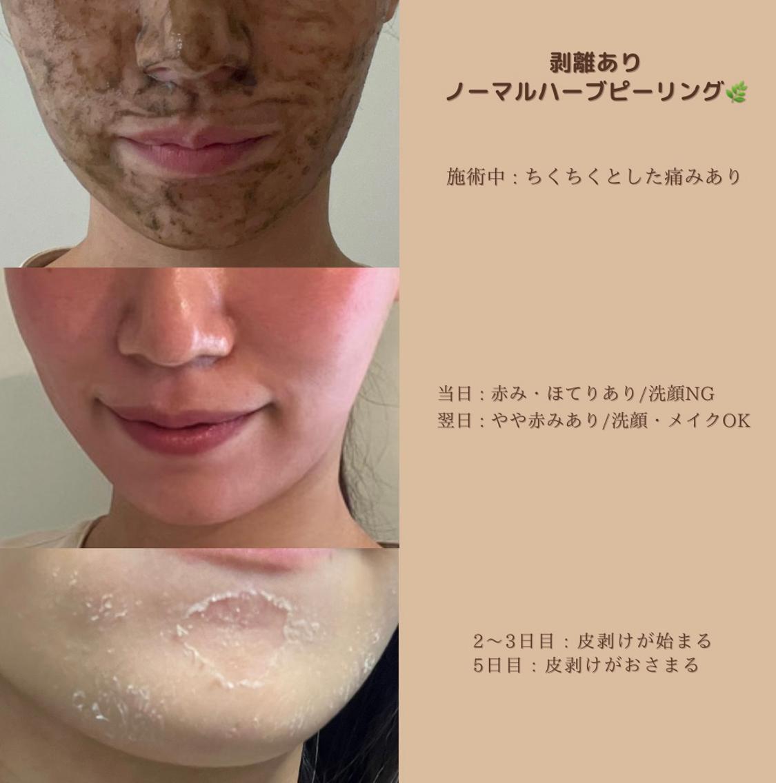 c3f81ff1cf9ba462df0afa219d57d2