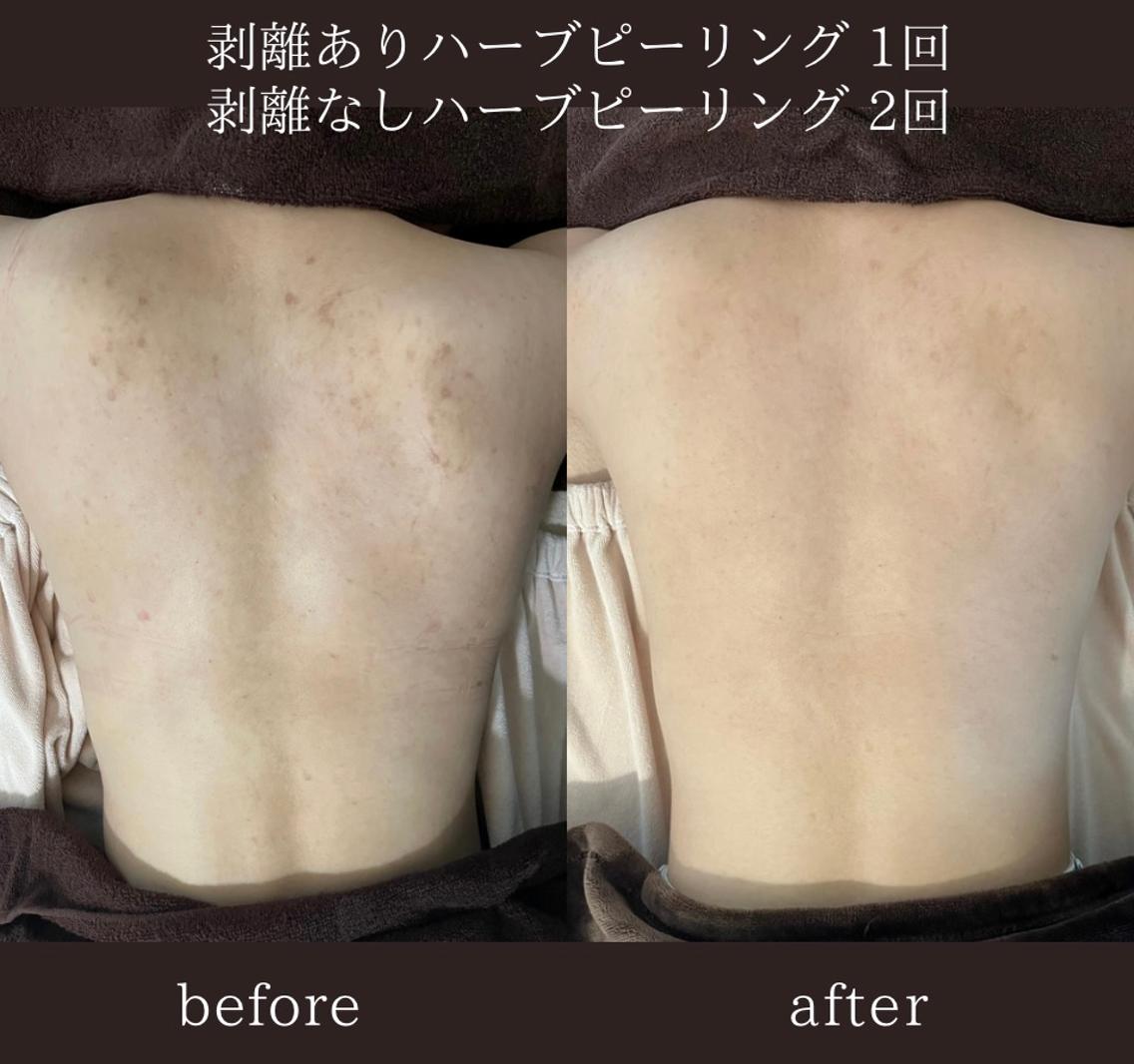 1352ab307173845b1f543bc220214d