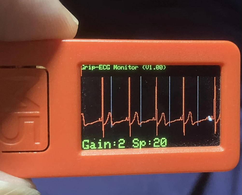 ベルト心電図センサユニット(BELT-ECGSENS01) — スイッチサイエンス