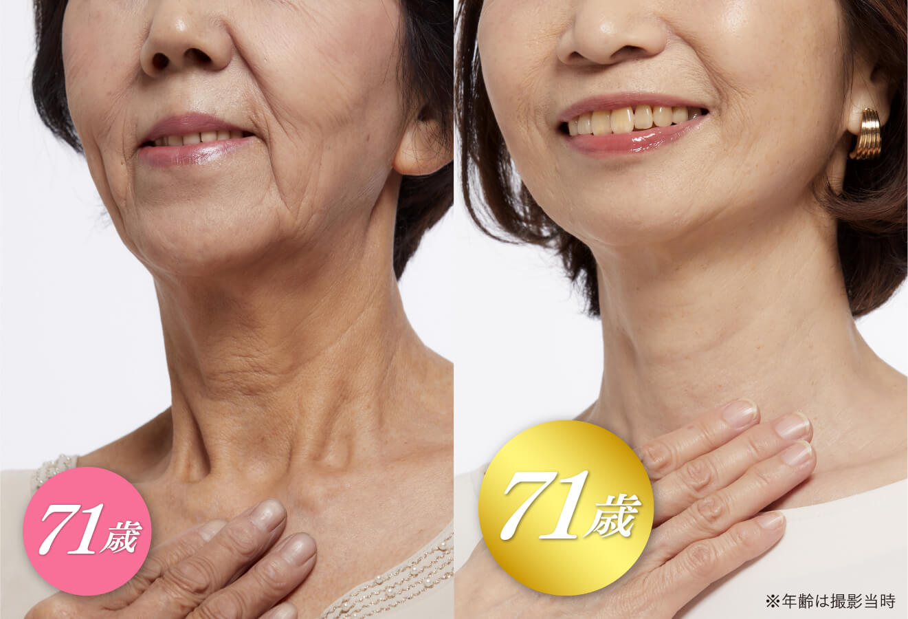 キミエリンクルホワイト｜富山常備薬【公式通販】