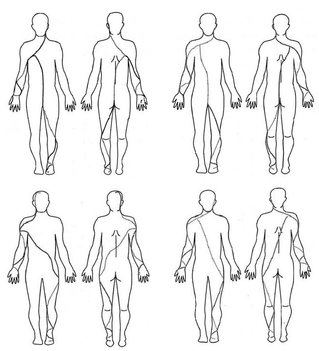 株式会社 医療情報研究所 | 螺旋筋膜からみた操体導診法
